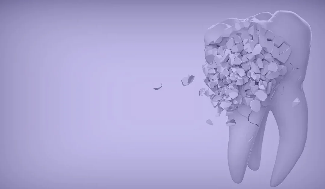 Emergency Spoonie Wisdom Tooth extraction